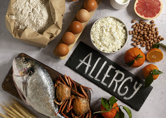 How to Handle Food Allergies and Dietary Restrictions as a Family Unit